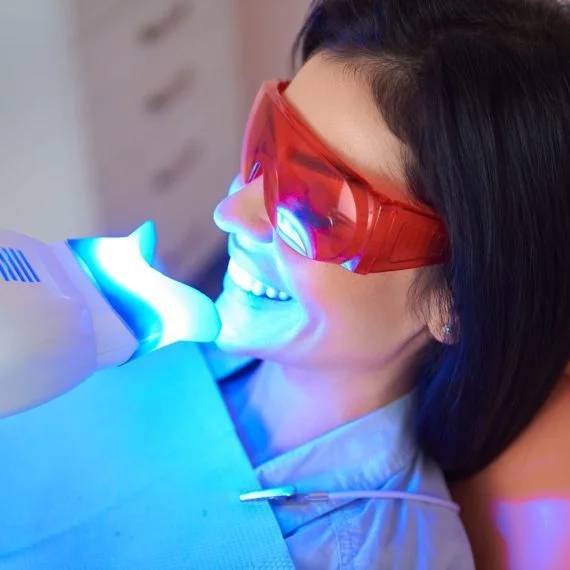 teeth whitening for students